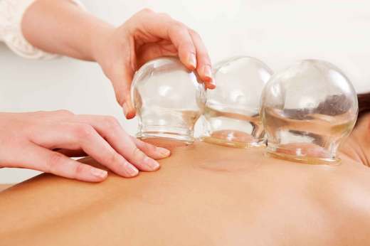 cupping-massage-therapy-featured.jpg